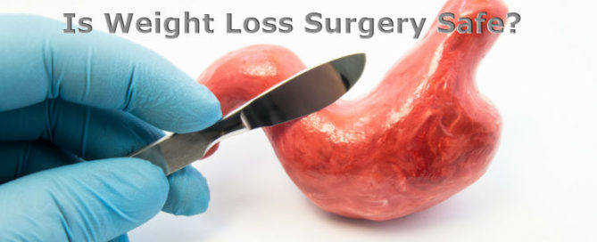Is Weight Loss Surgery Safe